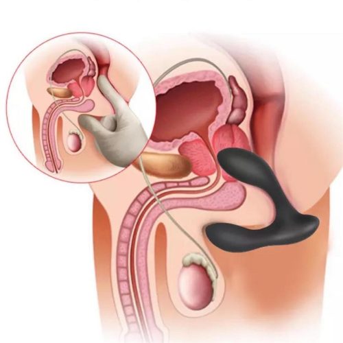 Brett távirányítós akkus prosztata vibrátor