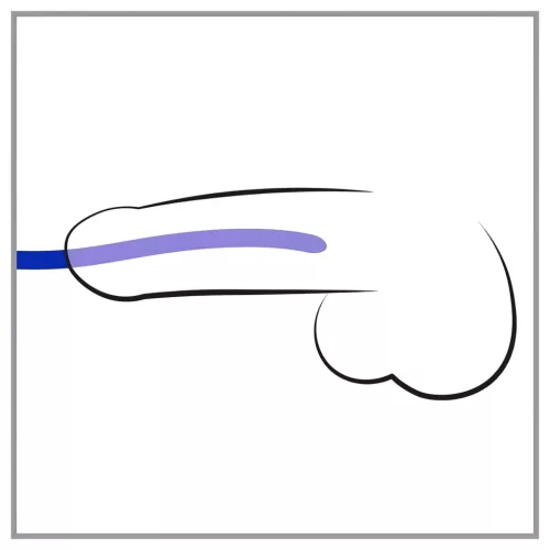 You2Toys - DILATOR - szilikon dilátor szett (3db)